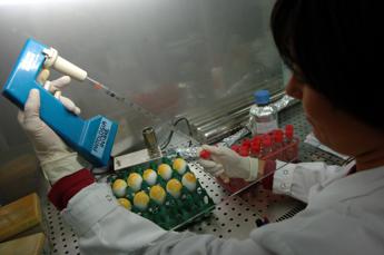 Aviaria, “casi umani sottostimati”: per esperte si rischia pandemia